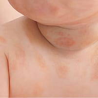 Application lait sur corps de bébé