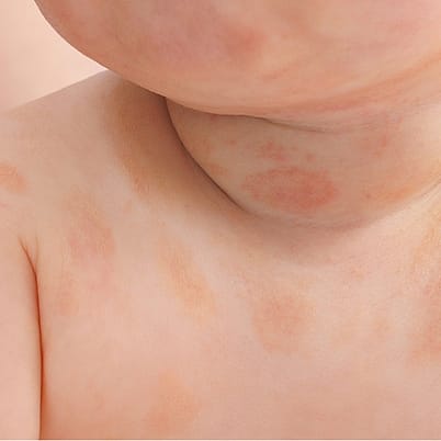 Application lait sur corps de bébé