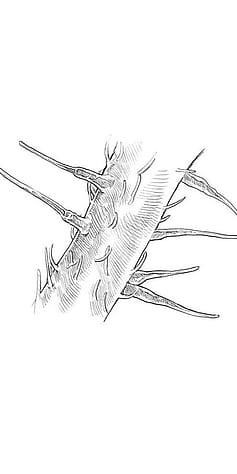 Poils urticants de la petite ortie
