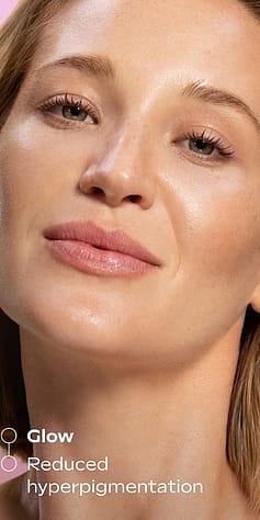Bild på tjej med texten Glow, reduced hyperpigmentation