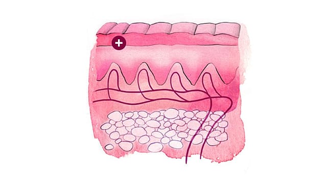 Illustration eines Hautquerschnitts: Hornschicht