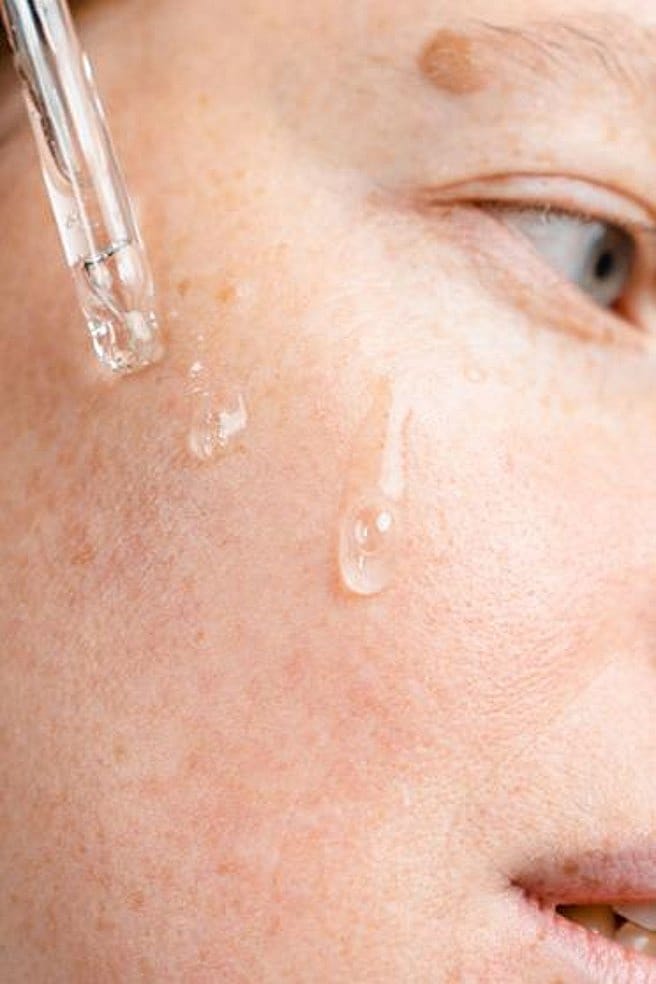 Frau Pigmentflecken Pipette Serum