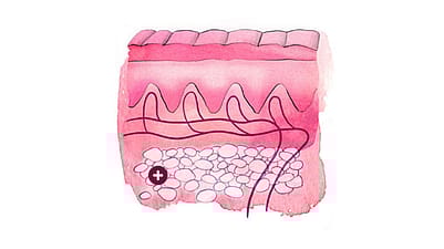 Illustration d’une coupe de la peau : hypoderme.