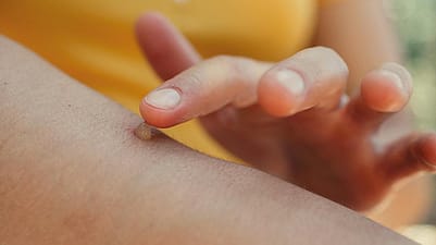 Application de pommade