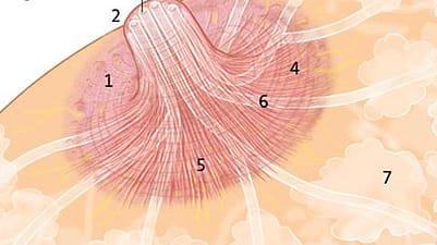 illustration mamelon