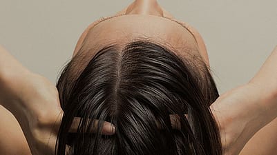 Woman massages head