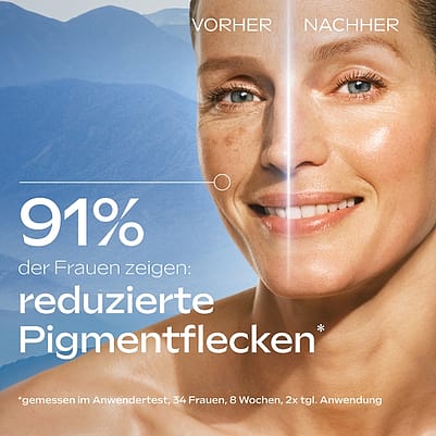 Anti-Pigmentflecken Bright Serum Packshot