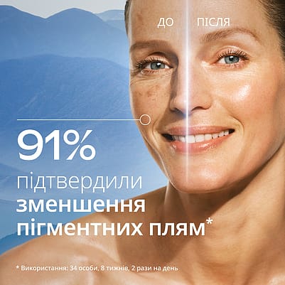 Comparison eye wrinkles
