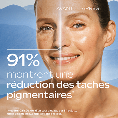 Sérum éclat Anti-taches