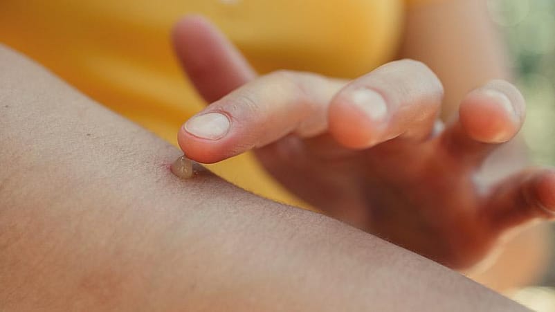 Application de pommade