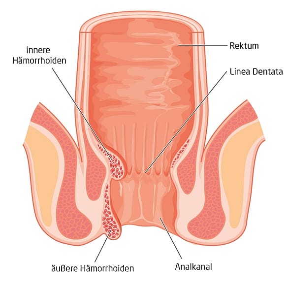 Medizinischer Querschnitt durch den Anus