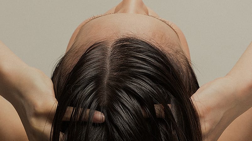 Dünner werdender Haaransatz von oben