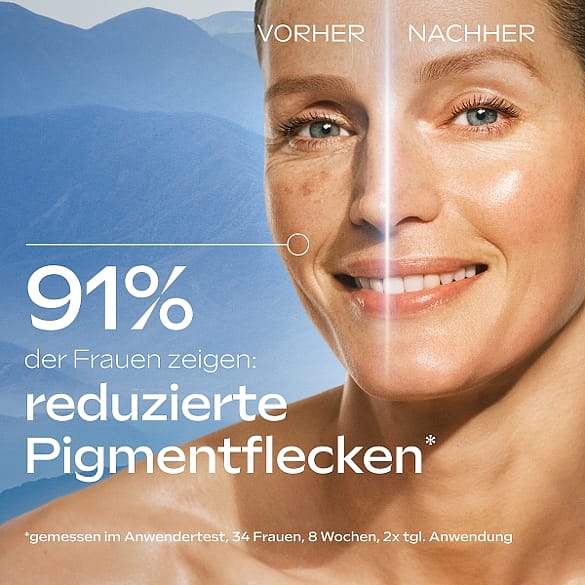 Anti-Pigmentflecken Bright Serum Packshot