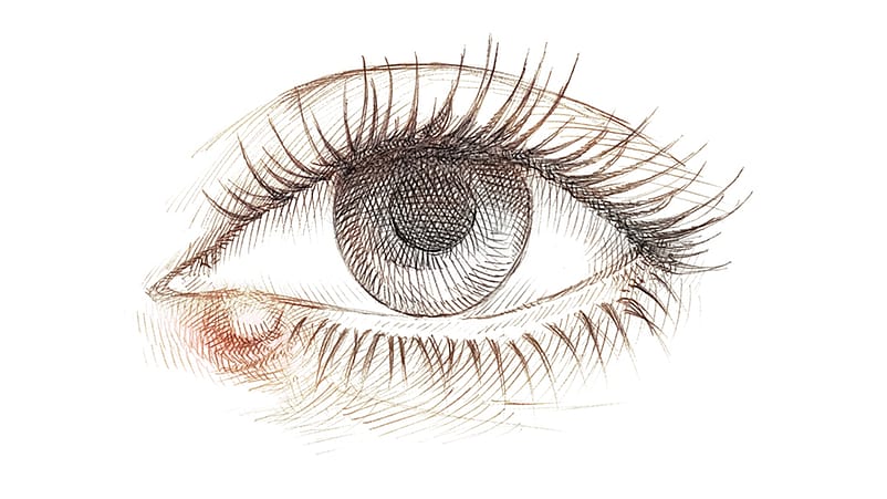 Illustration eines Auges mit Gerstenkorn