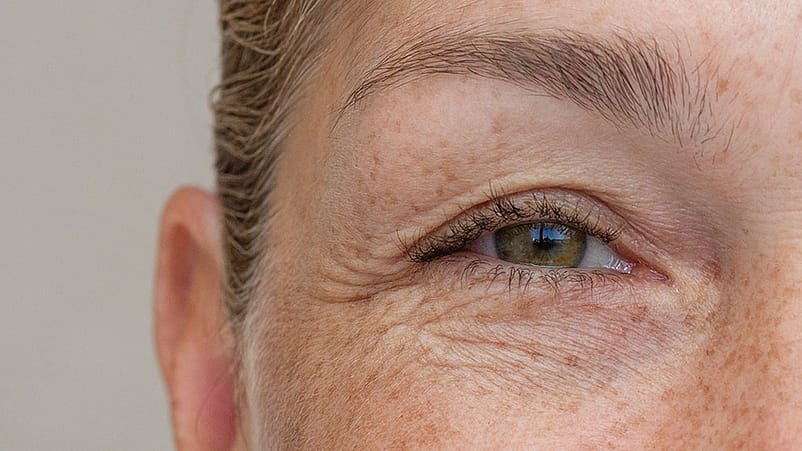 Gesichtsausschnitt mit Auge