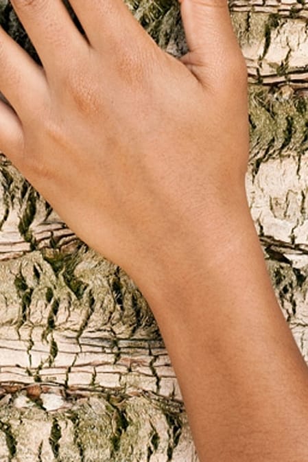 dry skin hands on tree