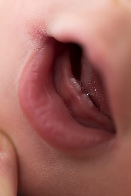 primeros dientes bebé