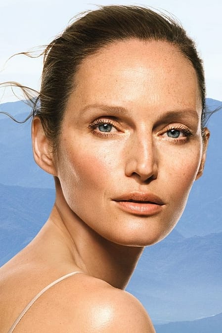 Taches pigmentaires, taches de vieillesse et taches de rousseur : Causes et conseils