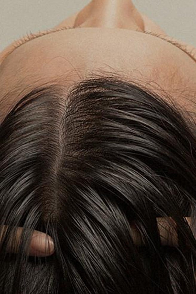 Dünner werdender Haaransatz von oben