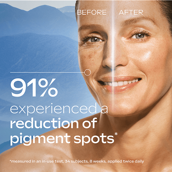 91% experienced a reduction of pigment spots