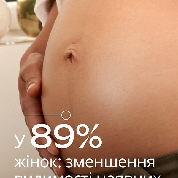 Баттер для профілактики розтяжок