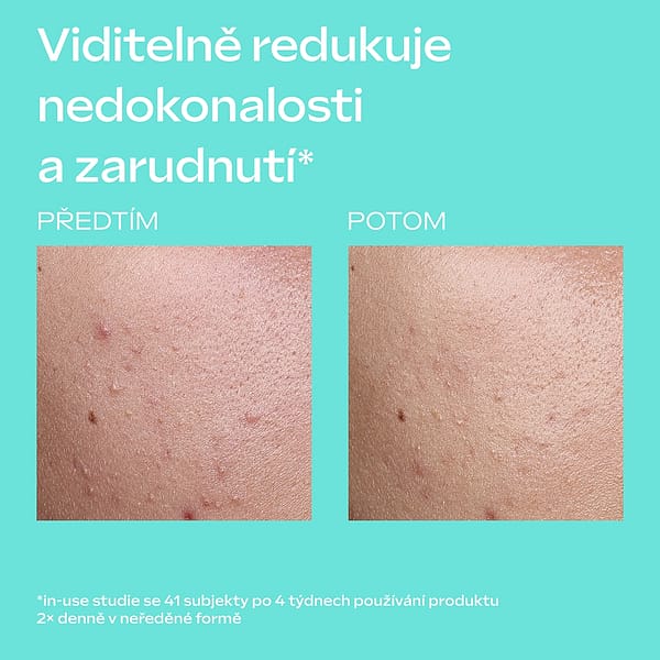 Clear & Pure Skin Serum Booster Drops