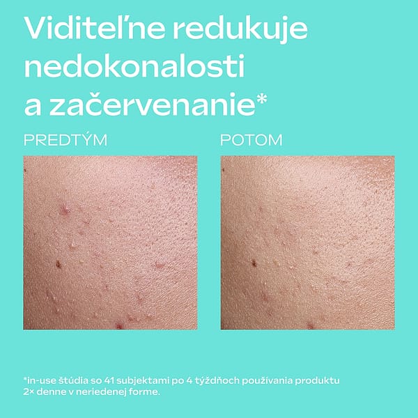 Clear & Pure Skin Serum Booster Drops