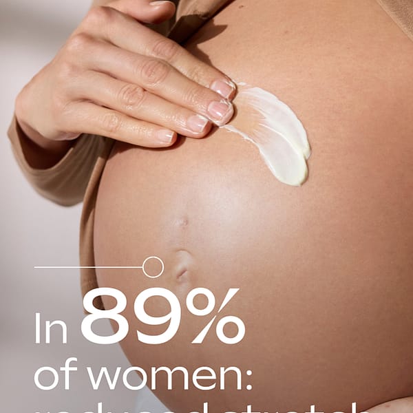 Stretch Mark Body Butter