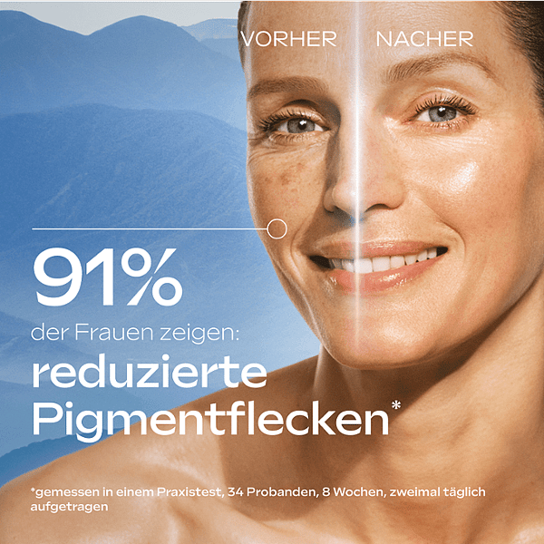 Anti-Pigmentflecken Bright Serum Blauer Enzian & Edelweiss